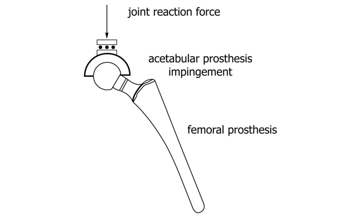 ASTM F2528 Figure 2