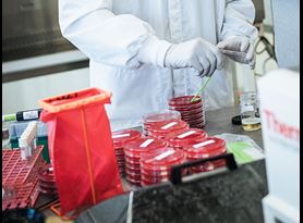 C. Diff & C. Auris Antimicrobial Efficacy Testing