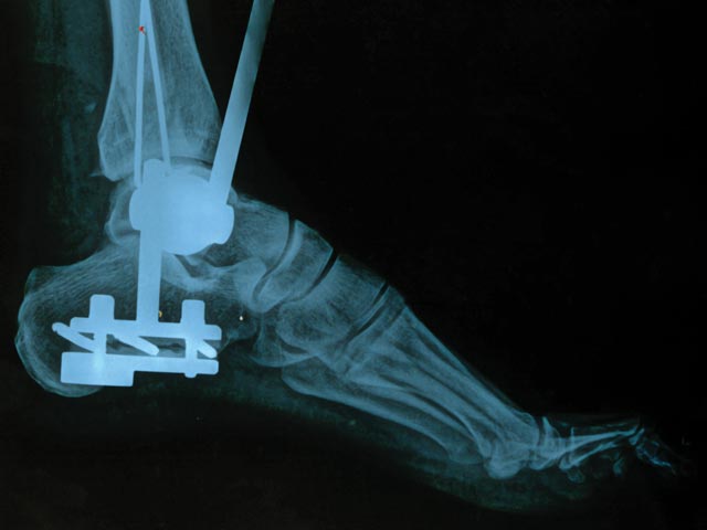 Medical-Device-Microbiological-Testing