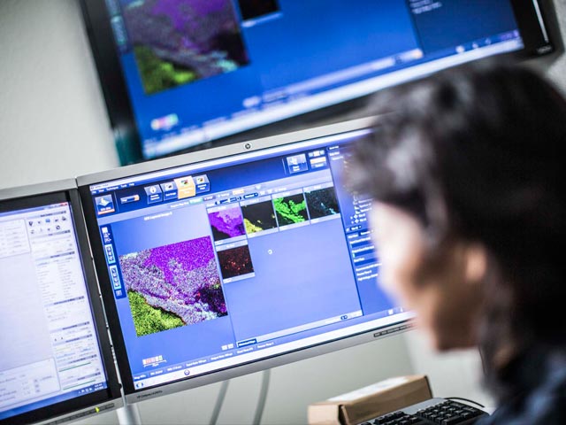 SEM analysis